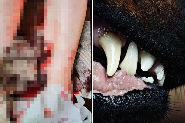 Hulking Rottweiler-husky cross left woman's leg hanging off in 48 hours of dog attacks