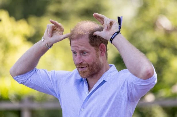 Prince Harry addresses going bald after claiming he's 'not ginger'