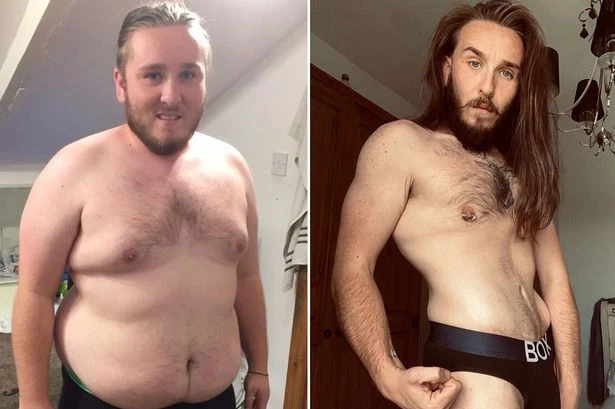 Costa manager left with 'melted' body due to loose skin after 14st weight loss