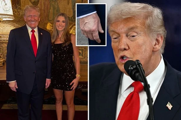 Donald Trump's granddaughter sparks health concerns through secret Instagram blunder