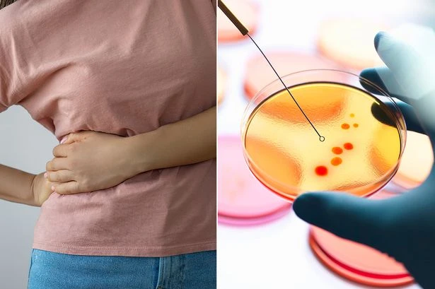 WHO warning issued over disease that turns skin yellow and blows liver up