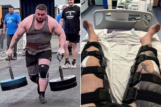 Brit strongman's freak injuries as kneecaps snap during one brutal exercise