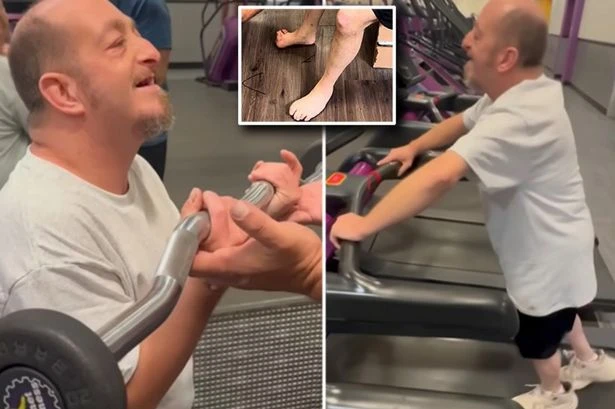 Member of America's most inbred family pumps iron at the gym with only 7 toes