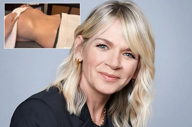 Zoe Ball wows fans with 'incredible' body transformation after Brazilian treatment