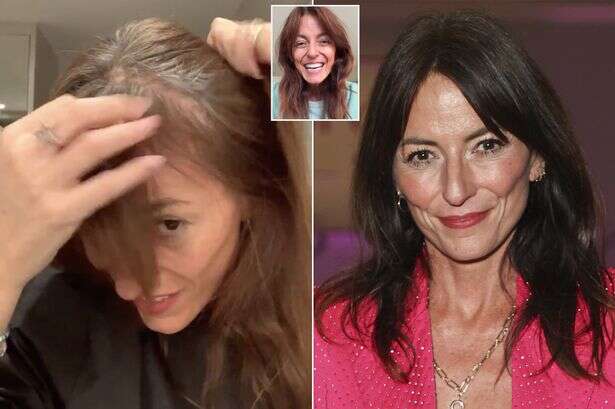 Davina McCall shows off brain surgery scar as she has first haircut since operation