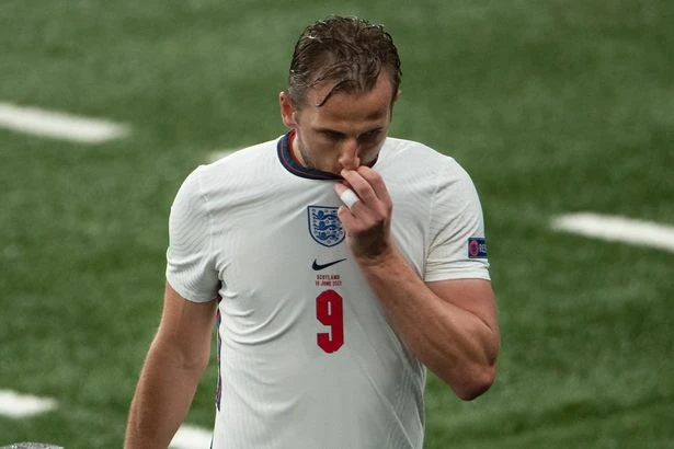 Harry Kane says Scotland draw is England's wake up call - but he's refusing to panic