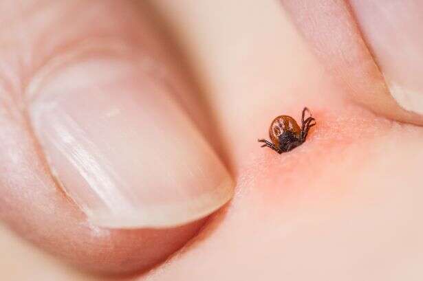 First case of fatal tick-borne virus detected as it 'buries itself in the brain'