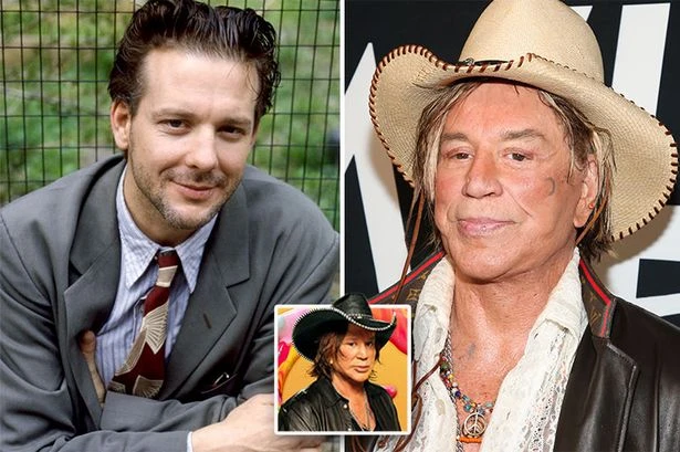 CBB Mickey Rourke's changing face – smashed bones, painful ops and 'wrong' doctor