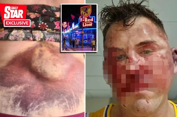 Hundreds of Brits randomly beaten up by knuckle duster-armed Benidorm bouncers, group claims