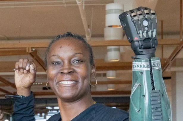 War veteran wounded in bazooka attack gets world's strongest 'Call of Duty' robot arm