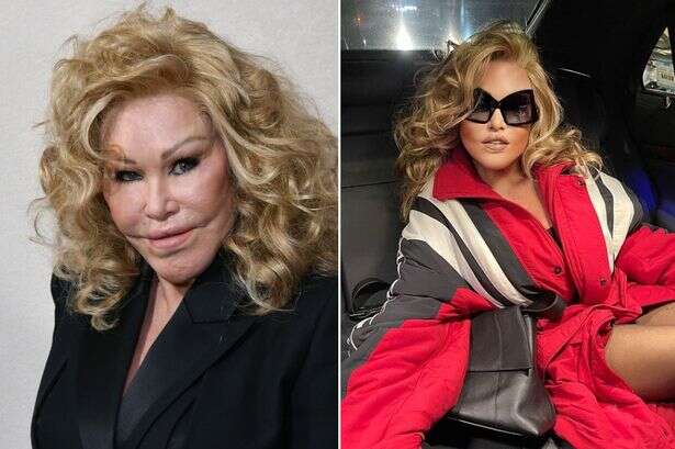 'Catwoman' Jocelyn Wildenstein's cause of death at 84 released after New Year's Eve tragedy