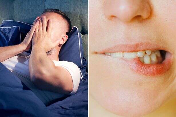 Teeth falling out dream is the most common plaguing Brits but what does it mean