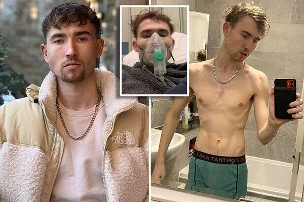 Man spent £2k a month on ketamine and became '7st skeleton' as his organs failed