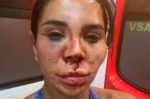 Beauty influencer disfigured after being tied up and attacked with bleach in terrifying raid