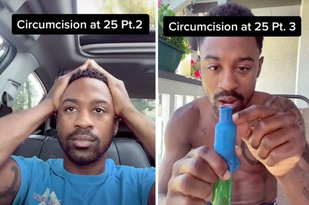 'I got circumcised at 25 as it hurt when I masturbated – now my penis looks bigger'