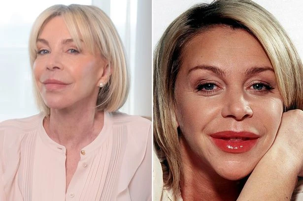 Leslie Ash unveils facelift results and looks '10 years younger' after years of insecurity