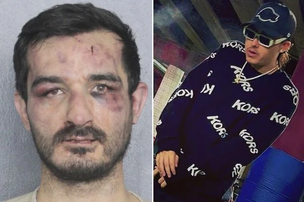Suspected burglar left black and blue after targeting MMA fighter's home
