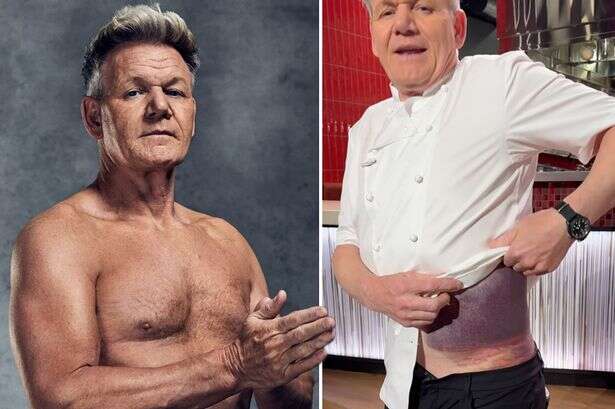 Gordon Ramsay 'embarrassed' as assistant had to put underpants on him after horror crash