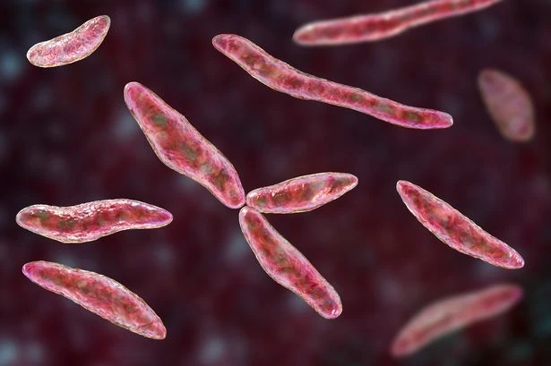 Plague linked to Black Death claims victim within hours of A&E visit as symptoms emerge