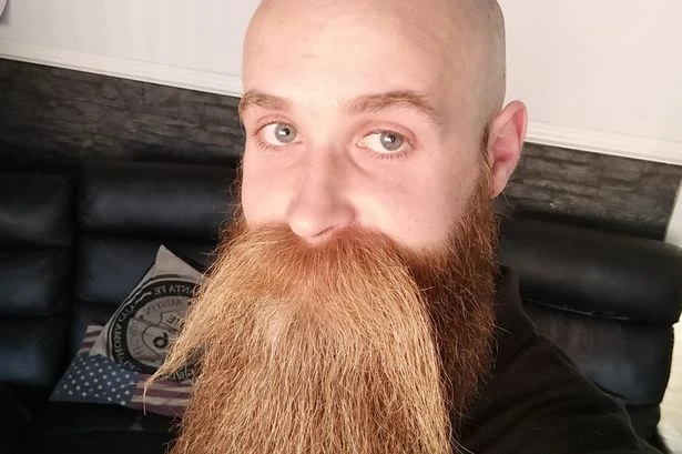 Bloke, 33, bullied at school for his facial hair becomes world champion