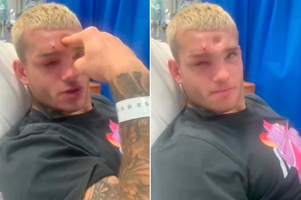 MMA fighter rushed to hospital with dent so deep he can put finger his in it