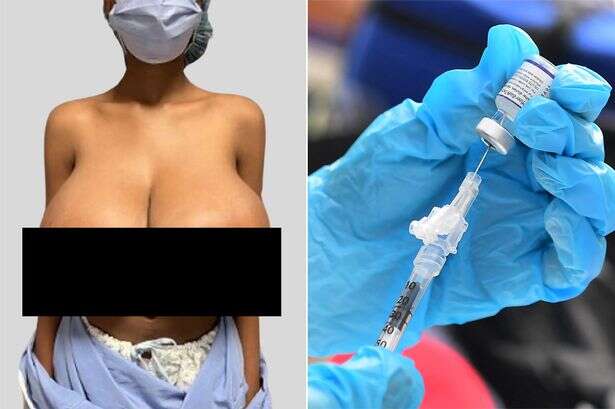 Woman, 19, sees breasts quadruple to enormous G-cup as Covid jab causes 'Pfizer boob job'