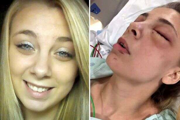 Woman who gouged her eyes out on meth sees the light and goes back to school