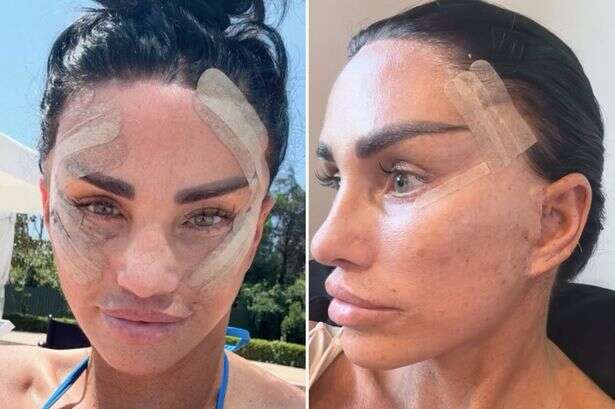 Katie Price seen with bandaged face in bed as she shows off facelift progress