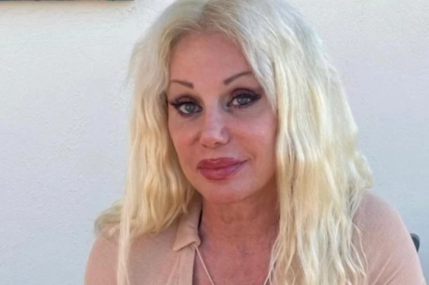 BREAKING Melissa Coates dead: Ex-WWE star dies aged 50 months after leg amputation 