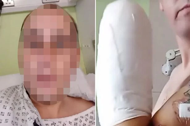 Pipe bomb moron dubs himself 'Captain Hook' after blowing his own hand off