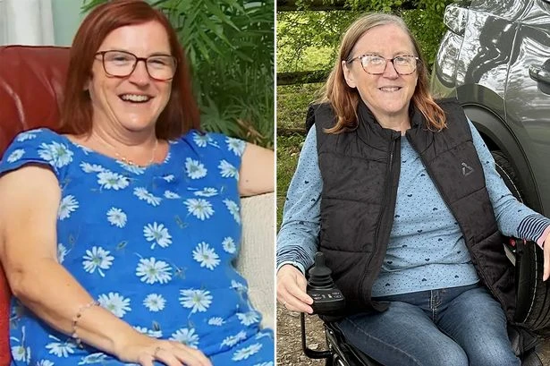 Gogglebox star left with 'irreversible' brain damage after losing sight while driving