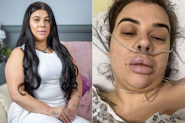 Woman's botched £5k 'mummy makeover' left her with just one boob – and it stank