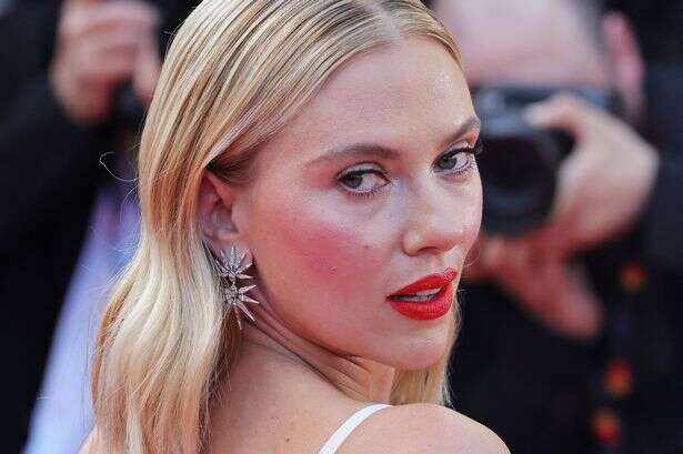 Scarlett Johansson left with 'hole in face' after trying to 'get rid of pimple'