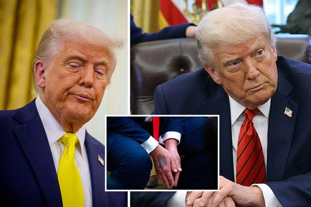 5 signs people think Trump is dead – from Pentagon Pizzas to mystery bruise
