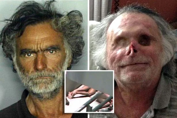 Homeless man had his face eaten by 'zombie' cannibal – and it was caught on camera