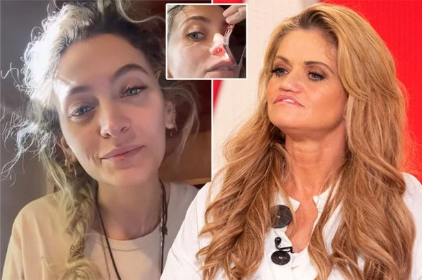 Dark 'truth' behind celebs with drug-induced nose 'holes' as Paris Jackson opens up