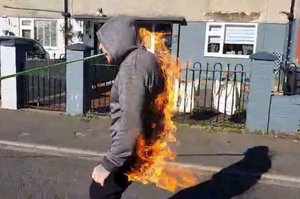 Strongman who dragged motor with penis pulls The Bill cop car with teeth - while on fire