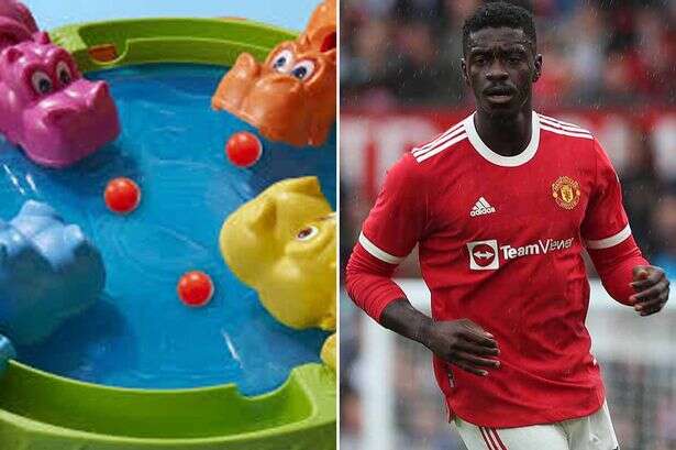 Ex-Man Utd Hungry Hippos world champion 'nearly loses thumb doing washing up'