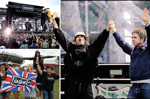 Oasis fans suffering from real-life medical condition as part of reunion gigs comedown