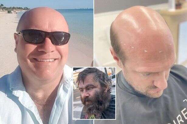 Men unrecognisable after hair transformations – from balding bus driver to homeless chap