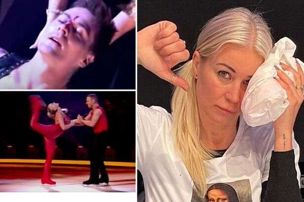 Dancing on Ice's most gruesome injuries from eye sliced open to chin being cut