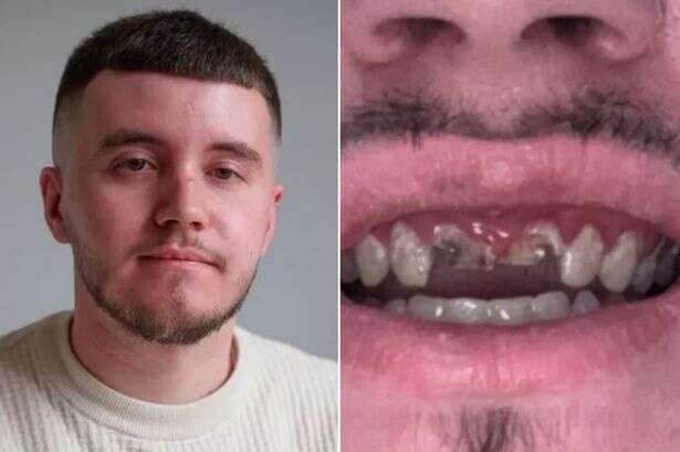 Man has his two front teeth nocked out by lunatic in a pub after having a nice chat with him