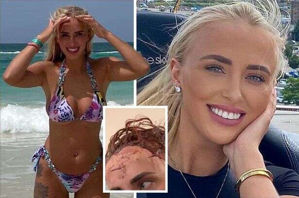 Beauty therapist fears she's scarred for life after being 'glassed' by female gang in bar