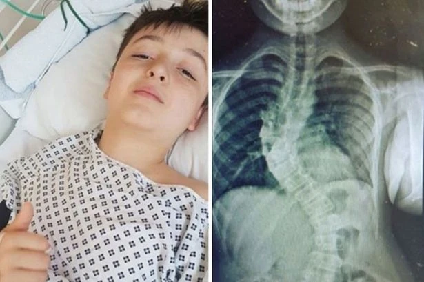 Eagle-eyed parents spot worrying sign on son in bath prompting life-changing diagnosis