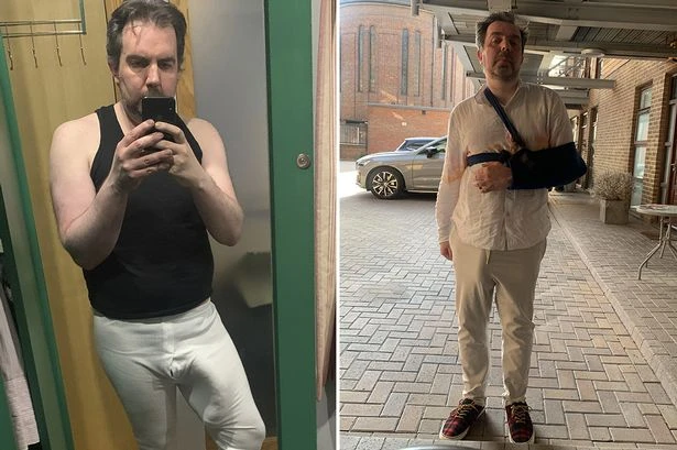 Man with 'world's biggest willy' breaks arm in shower as huge todger 'got in the way'