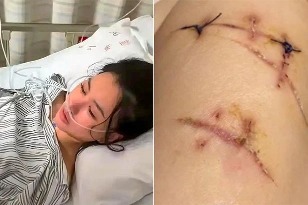 Woman stabbed 22 times in shopping centre carpark – but her boob implants saved her life