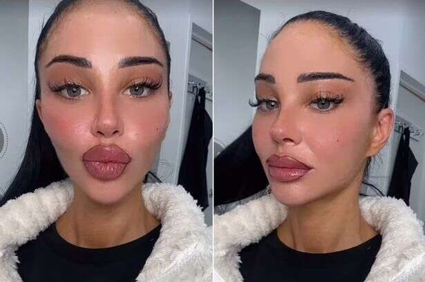 Tulisa shows off swollen new lips after getting them tattooed before I'm A Celeb