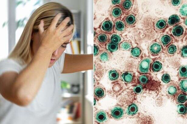 Banging your head could give you herpes as 'zombie' viruses 'wake up', study finds