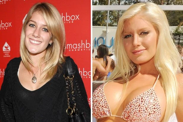 The Hills icon Heidi Montag's transformation with 10 surgeries in one day and new career