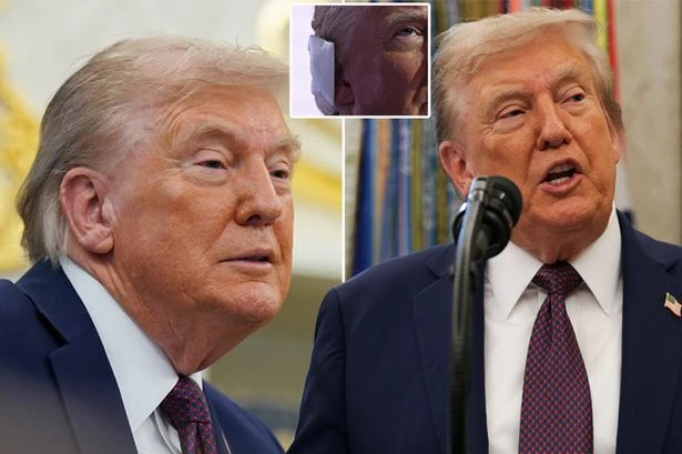 Fresh Trump 'body double' conspiracies as president 'looks rough' and ear pic examined